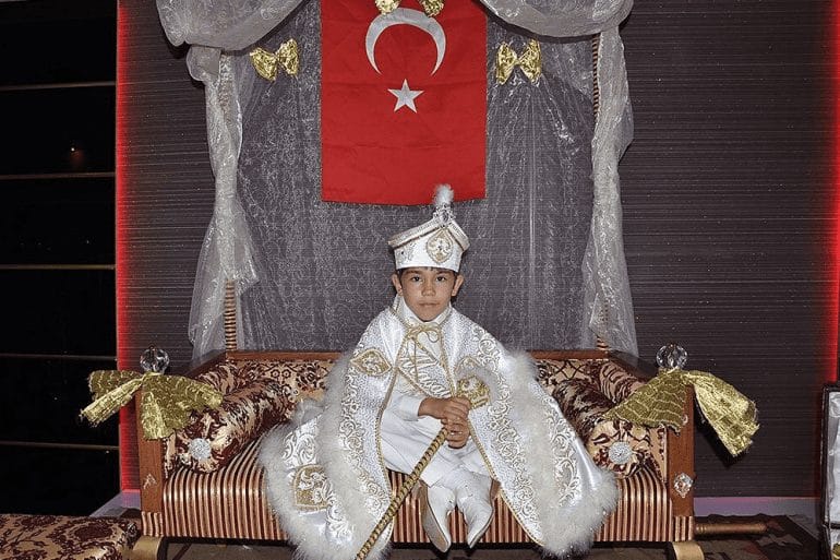  ما لا تعرفه عن “عرس الختان” لدى الشعب التركي